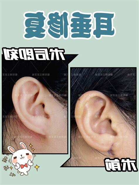 耳垂脫皮