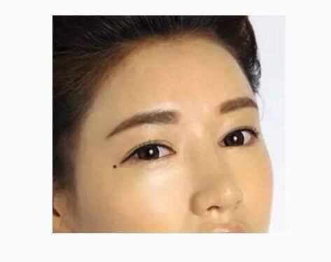 夫妻宮有痣女