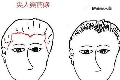额头有坑