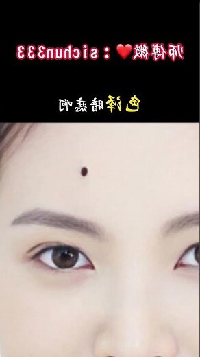 克夫痣意思