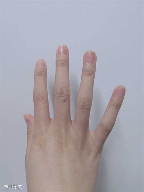 右手中指有痣女