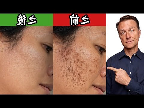 斑意思