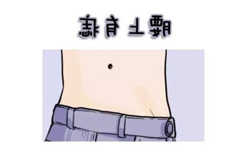 腰间有痣
