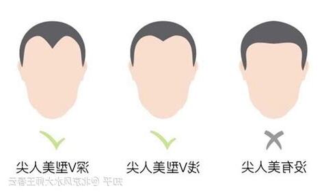美人尖面相男