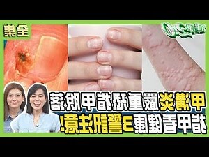手掌橫紋多
