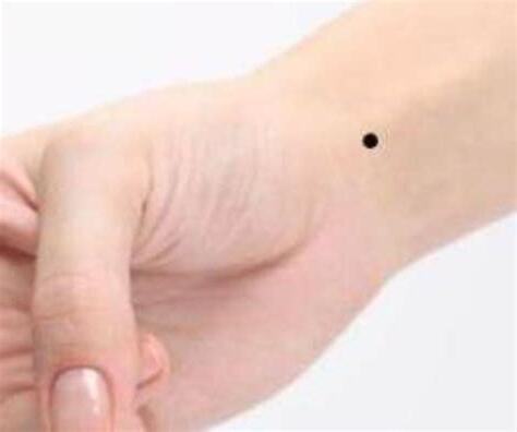 左手腕上有痣