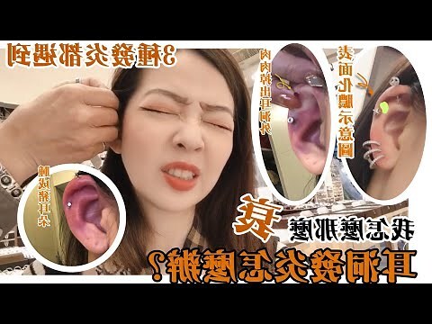 耳洞發炎腫起來
