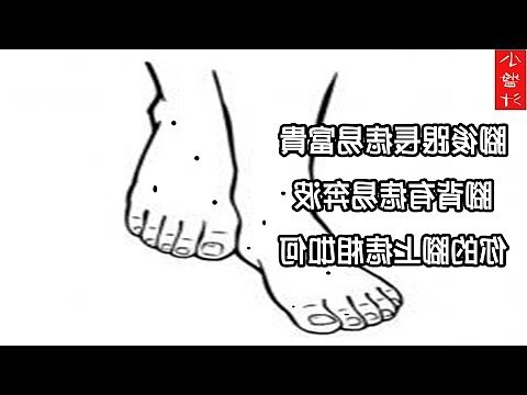 腳背痣圖