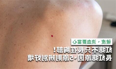 胸部的痣