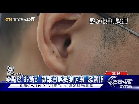 為甚麼會長痣