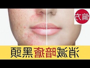 眉頭暗瘡
