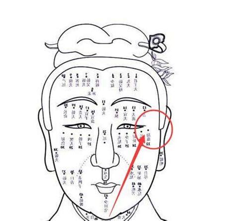 右眼皮上有痣女