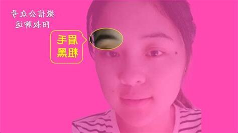 波折痣
