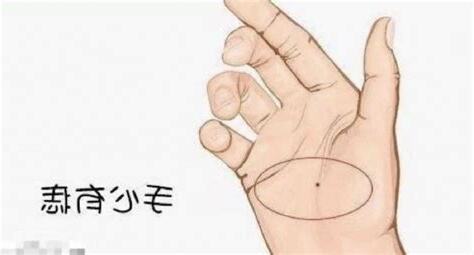右手內側有痣