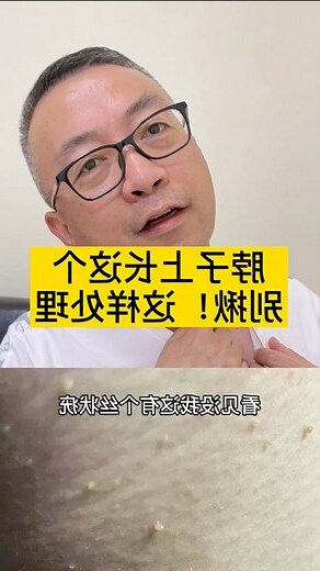 下巴有肉