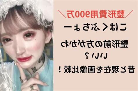 琥珀部長整形