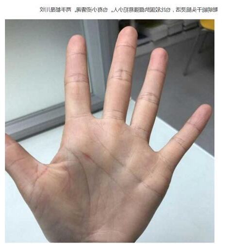 手指直紋