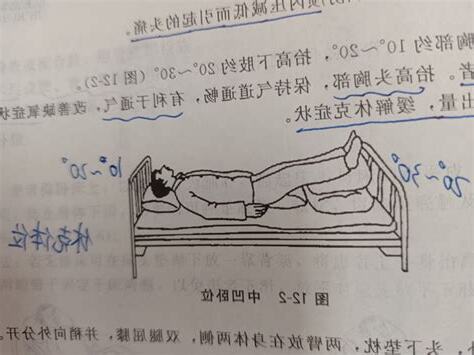 截刀卧位