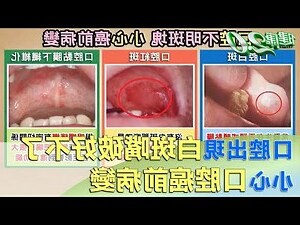 嘴角白白
