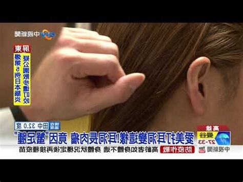 打耳洞變衰