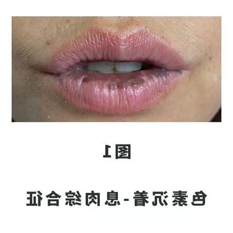 嘴唇上有墨