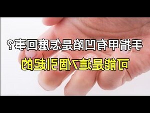 指甲凹