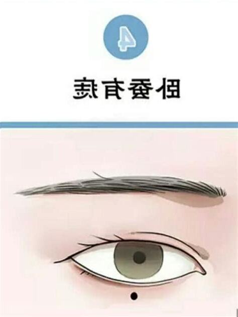 臥蠶有痣