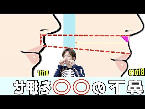 人中部位