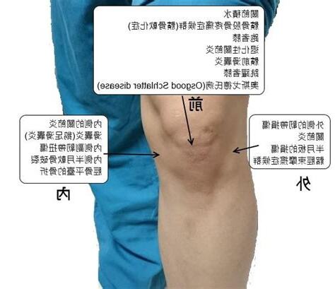 左膝蓋內側有痣