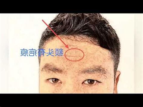 額頭上有疤