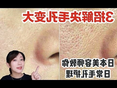 臉上智慧毛