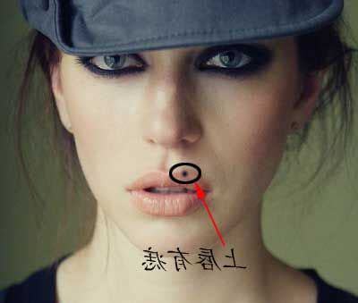 嘴唇的痣可以點嗎