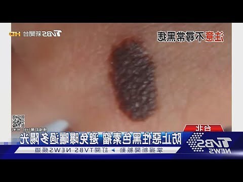 黑毛痣原因