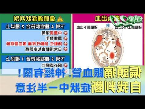 無故頭痛