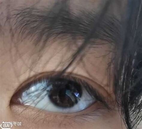 眼珠小眼白多