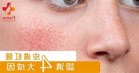 人中紅紅的