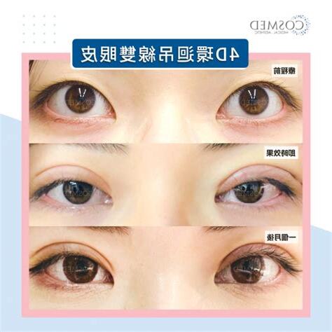 內雙眼皮面相女