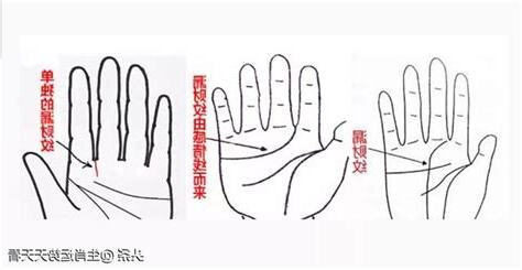 漏財紋化解