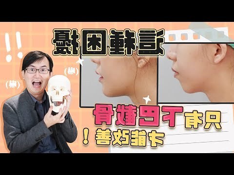 下巴凹槽