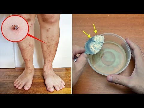 跳蚤多小