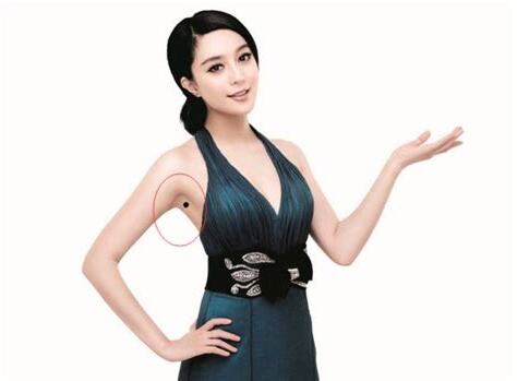 腋窩有痣