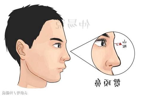 鼻若懸膽
