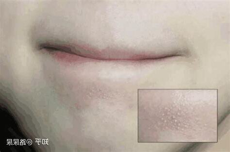 脸上有白毛
