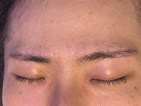 眉毛長一顆
