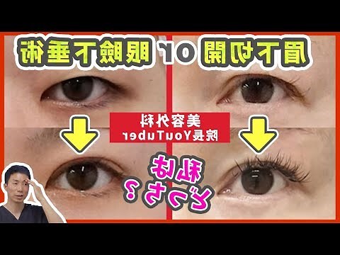 眼角下垂面相