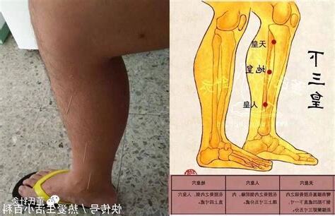 三皇穴位置