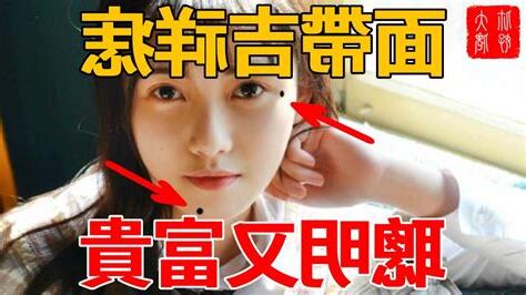 聰明痣