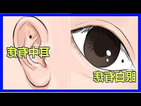 身體長痣的意義