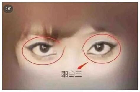 眼白面相