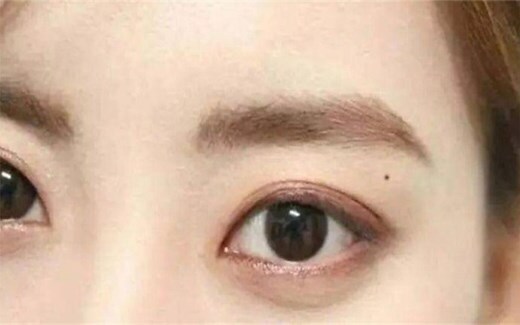 左眼皮上有痣